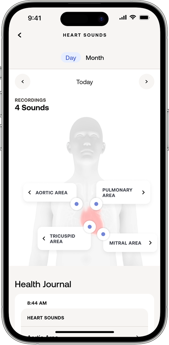Heart Sounds measurement screen 1