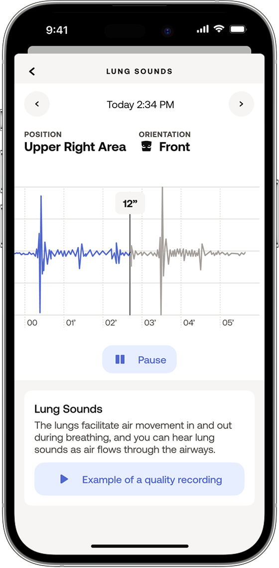Heart Sounds measurement screen 3