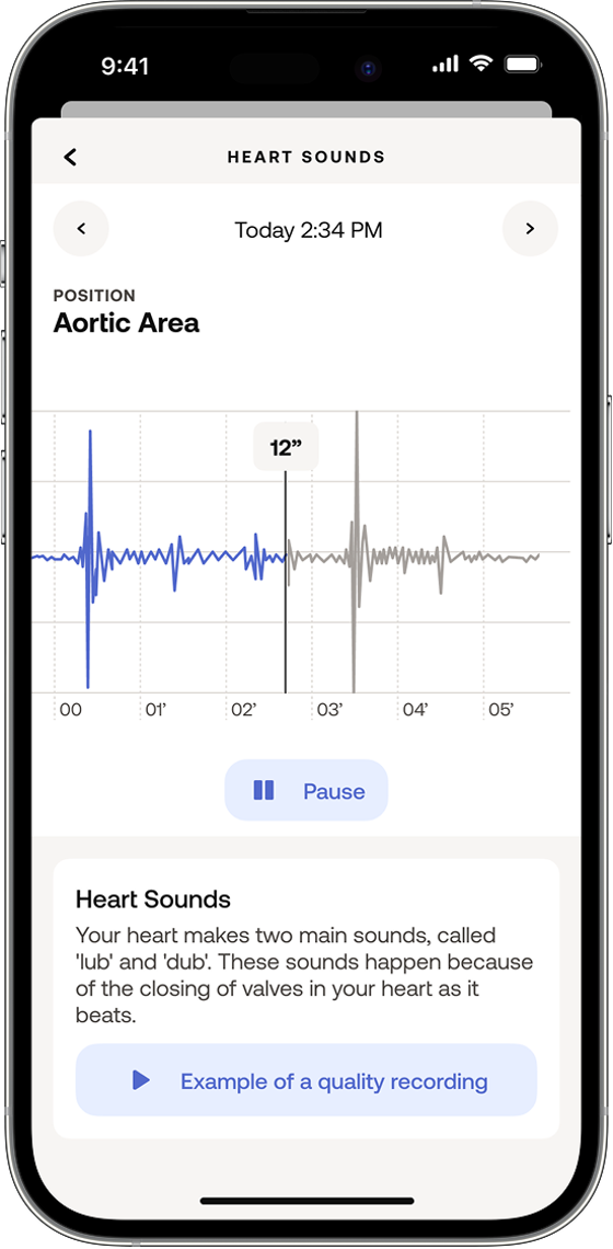 Heart Sounds measurement screen 4